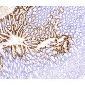 Cytokeratin 20 (CK20)